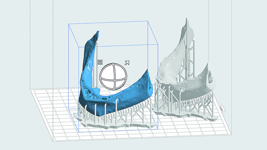 Fig. 21: PreForm software designing supports to fabricate two separate mandibular models.