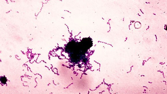 Кариесогенна бактерия може да допринася за разграждането на композиционните материали