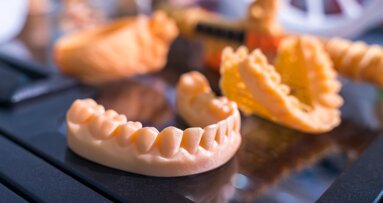 Same-day 3D-printed restorations—taking chairside 3D printing to the next level