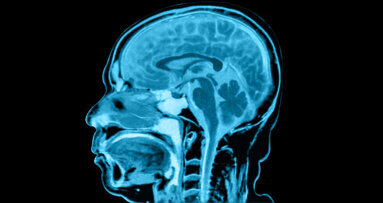 Man loses memory after root canal treatment