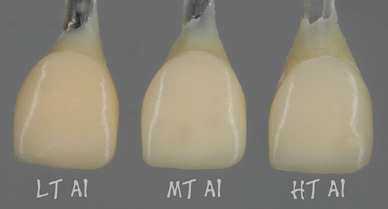 Fig. 2a: Differences in value and chroma without the effect on the shade by the abutment; the veneering ceramics do not touch the preparation. 