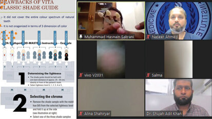 AIDM webinar on 3D shade guide, teeth selection