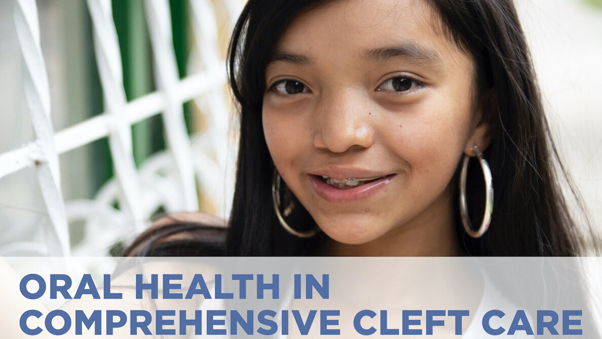 Webinaire de la FDI : La santé bucco-dentaire dans la prise en charge de fentes labio-palatines