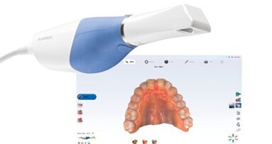 Planmeca Emerald S: escáner de alta velocidad que es fácil de usar