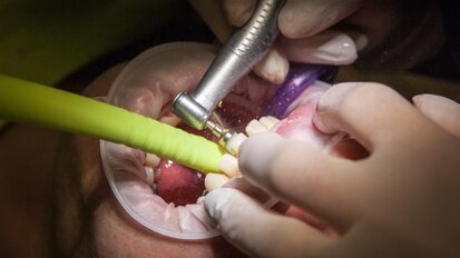 Najwyższa Izba Kontroli o darmowym leczeniu zębów