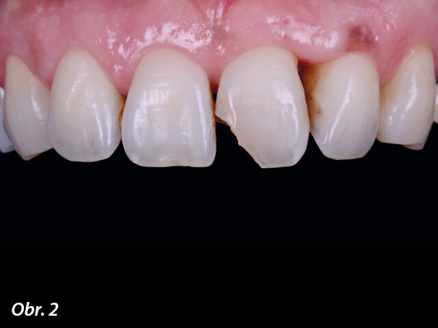 Kazuistika 1 – výchozí stav.