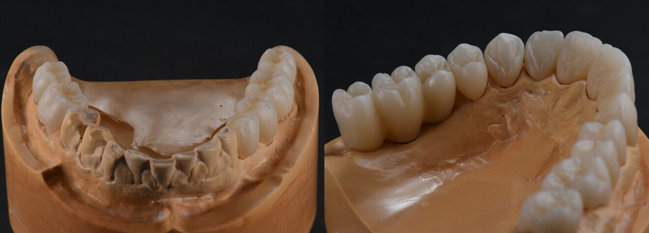 Figs. 7a & b: The surface structure can still be seen after sintering.