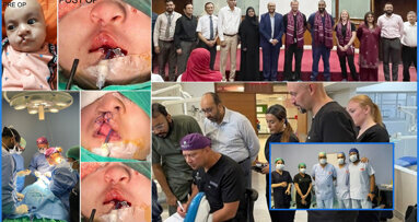 First welfare cleft mission by JMDC