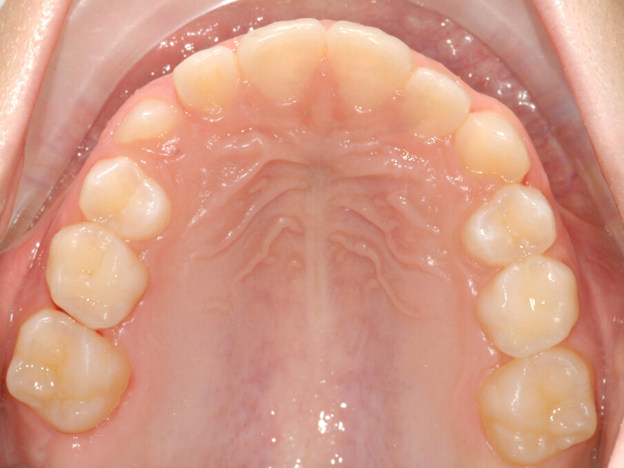 Fig. 11_Follow-up 1 anno.