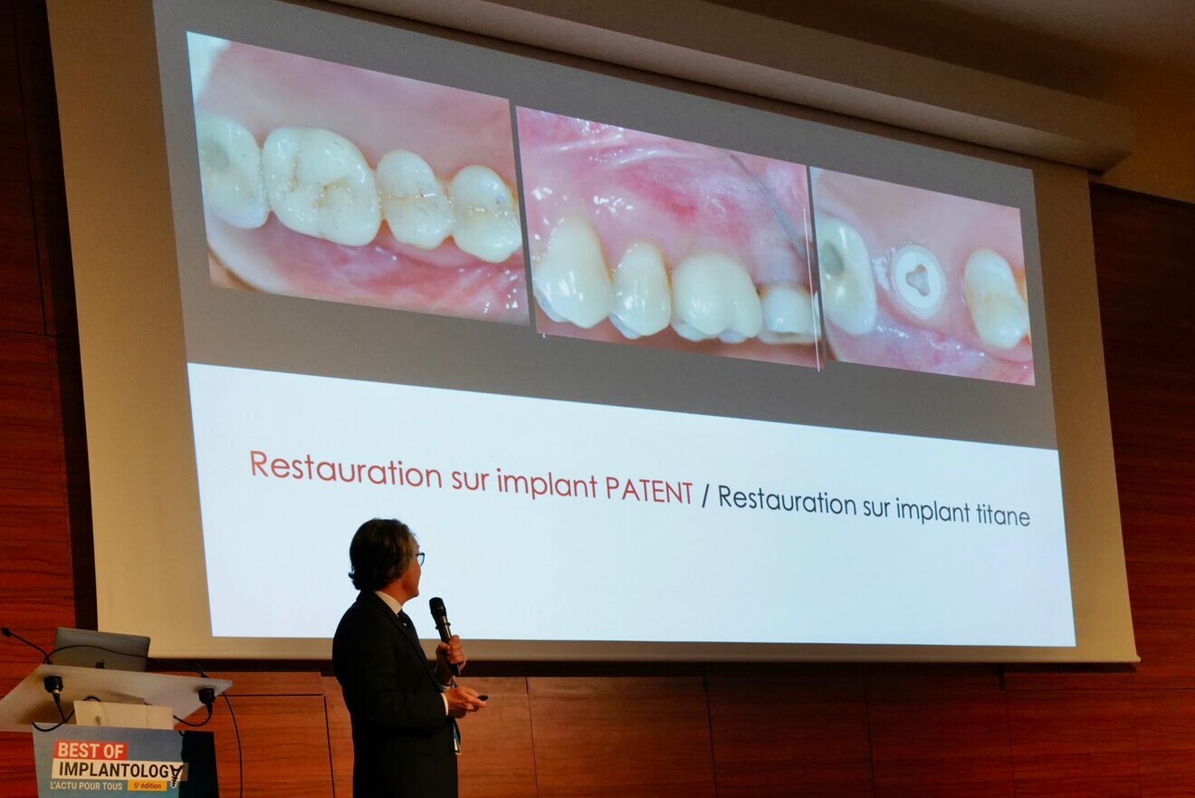 Présentation du Dr Fabrice Baudot au Best Of Implantology 2024. (Photo : Patent)