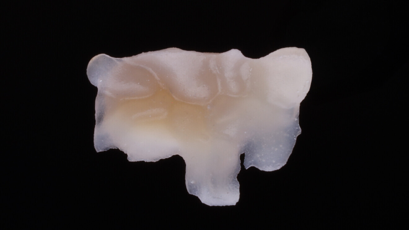 Fig. 21: Extra-oral occlusal view of the semi-direct inlay.