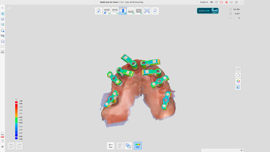 Fig. 14: Medit SmartX workflow for intra-oral scanning of the full arch using the Medit i900 and Medit Scan for Clinics (Version 1.13.2).