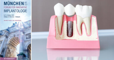 Implantologietrends im Oktober in München