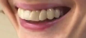 Alba Rohrwacher's teeth after.