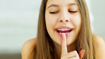 Relationship between early orthodontic treatment and OH-related quality of life confirmed