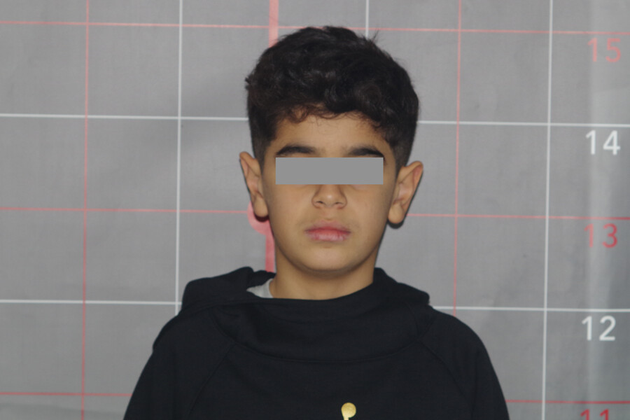 Fig. 11a: Facial photographs at the 24-month follow-up: frontal view.