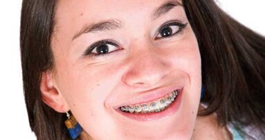 AAO expands its Donated Orthodontic Services program to include more children