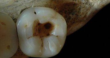 Eerste gaatje 14.000 jaar geleden ‘geboord’