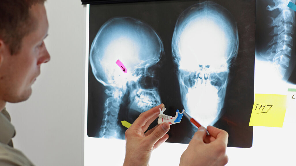 Norwegian study finds high pain intensity is a risk factor of non-resolving TMD