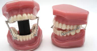 The orthocaps Rainmaker appliance: Clinical illustration and conclusions