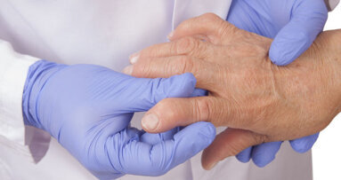 No evidence for link between periodontal disease and rheumatoid arthritis