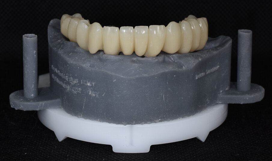 Fig. 16 - Modello digitale e provvisorio.