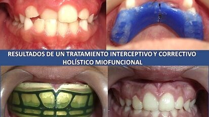 El Dr. Arturo Alvarado sobre el Diplomado Internacional en Ortopedia Craneofacial