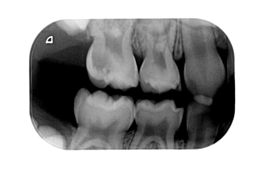 Afbeelding 9. Casus 3: 18-10-19. BWR, zie 55.