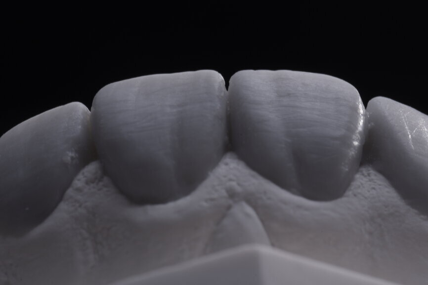 Fig. 29: Final wax-up of all units.