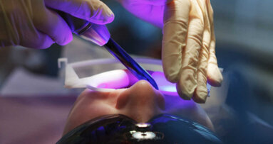 Znanstveniki pred odkritjem novega zobnega restavracijskega materiala