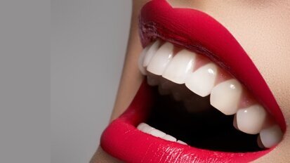 3 fakty na temat licówek