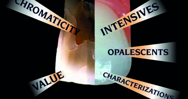 Iskorak izvan klasičnih ključeva boje za postizanje što prirodnijih zubnih nadoknada