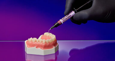 CLEARFIL MAJESTY ES Flow Universal wins research award