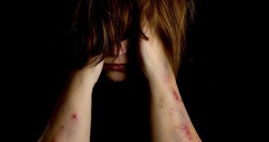 Opfer häuslicher Gewalt erhalten neues Lächeln