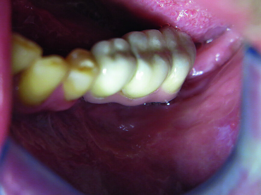 Fig. 8: Final situation.