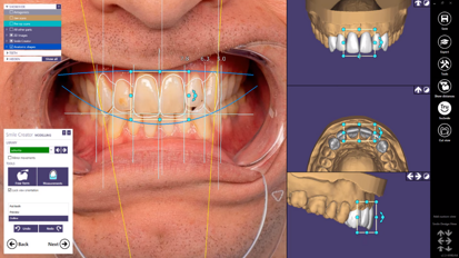 exocad – Quick Guide: Get the most out of your Smile Creator Module!