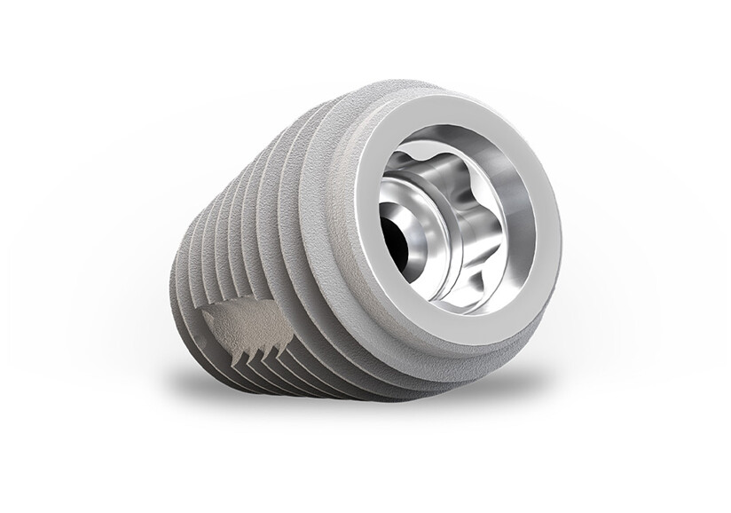 Keystone Dental Group – TiLobe Connection