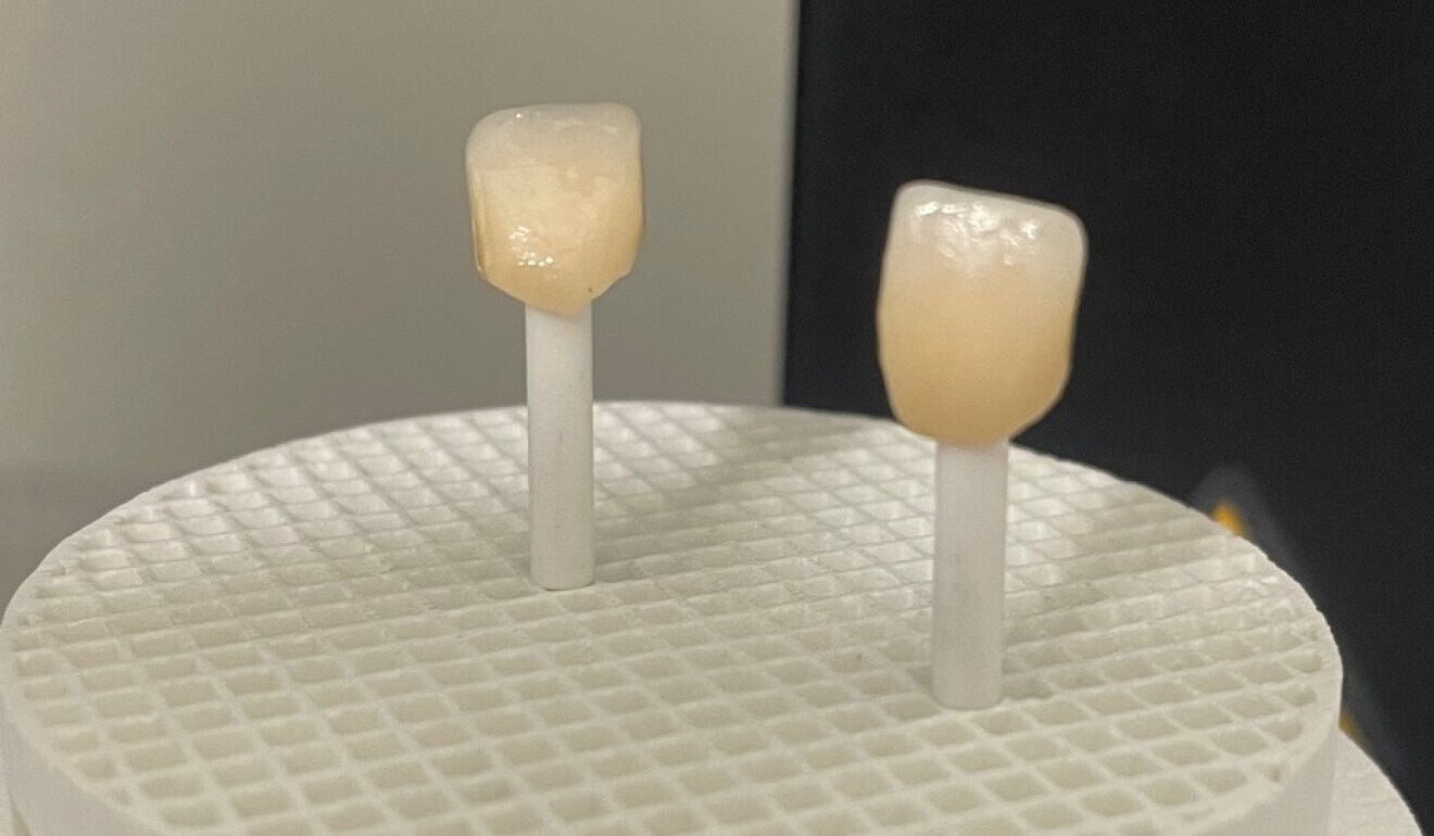 Fig. 7: Crowns in the furnace after staining and glazing with liquid ceramics.