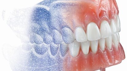 AvaDent heeft met digitale prothese de toekomst