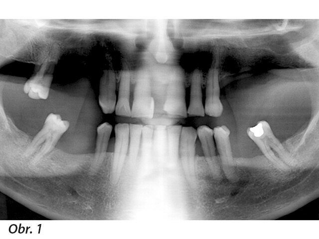 Kazuistika - iniciální situace