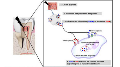 Découverte fondamentale sur le pouvoir naturel de réparation des dents