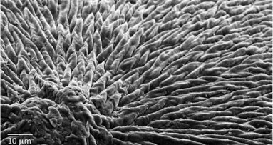 Researchers develop material that could emulate dental enamel