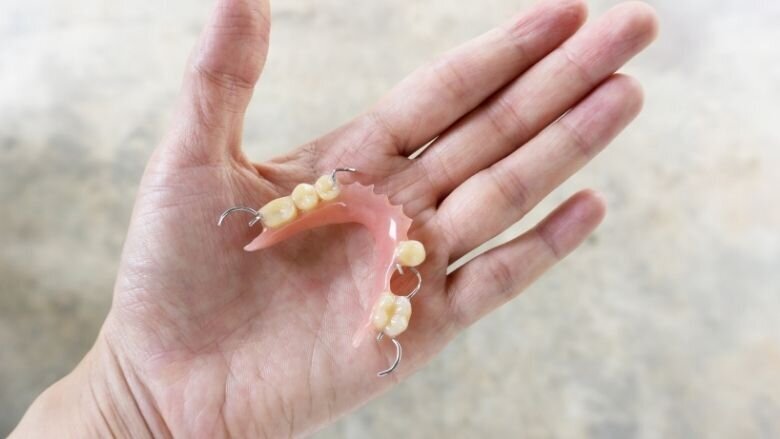 Afbeelding 1. Afspraken na het eerste gesprek over mondhygiëne over het dagschema.