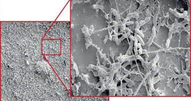 Quando l’infezione rientra fra i rischi lavorativi e assistenziali dello studio odontoiatrico
