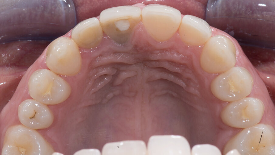 Figg. 2-4_Immagini iniziali.