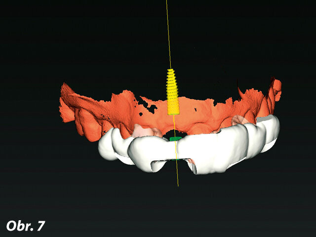 Obr. 7: Design navigační šablony