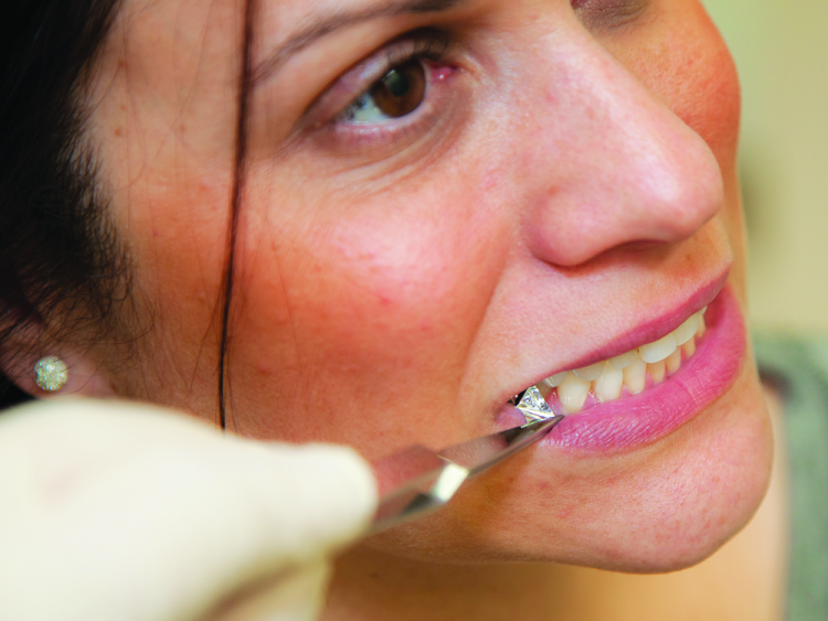 Fig. 7: Occlusal contacts