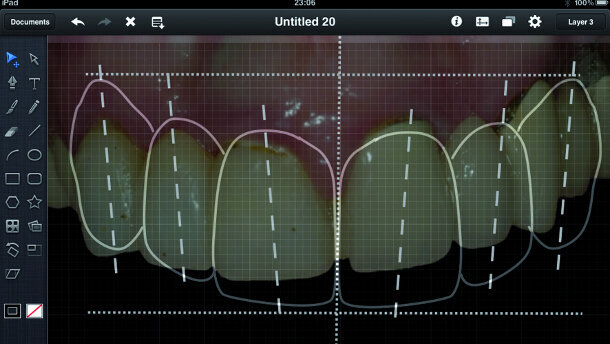 ADF 2015 : Utiliser l’iPad au cabinet dentaire