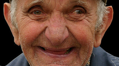 Veza između sposobnosti žvakanja i smanjenog rizika od demencije