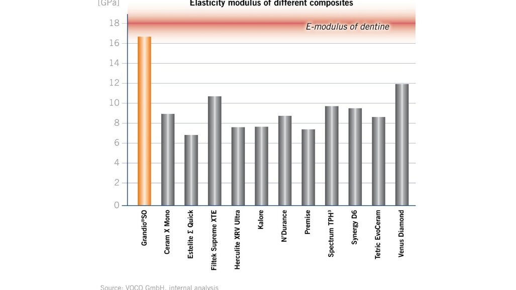 Μέτρο ελαστικότητας όμοιο με του δοντιού – ασφαλέστερη αποκατάσταση!